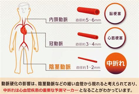 挿入 萎える|「勃起はするけど途中で萎える」中折れED、年代別。